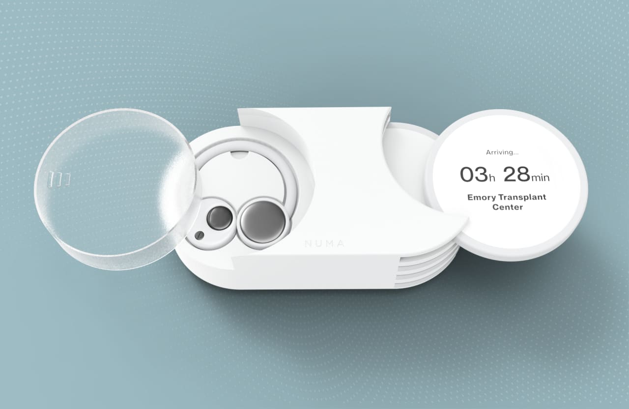 Phase 1 — Wearable to Standalone Camera